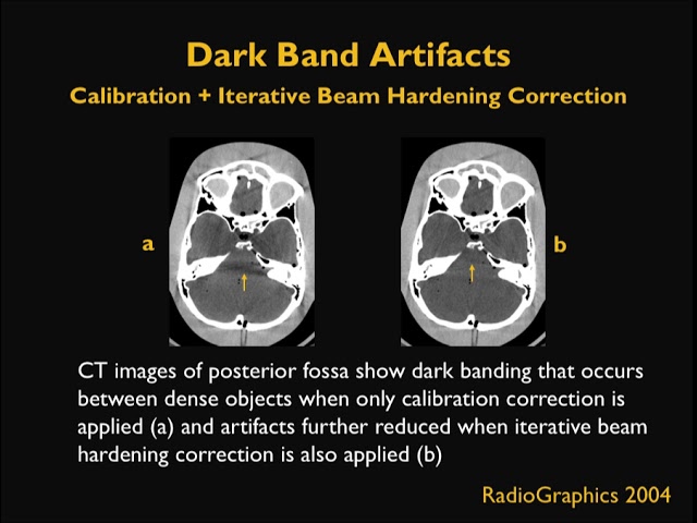 Expanding Applications for Computed Tomography | Imaging Technology News