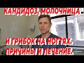 Кандидоз, молочница и грибок на ногтях. Причины и лечение.