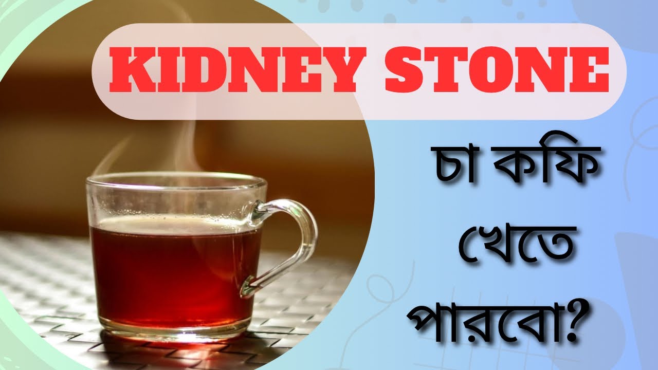 Kidney stone হলে কি চা কফি খাওয়া যায় ? Can kidney stone patients