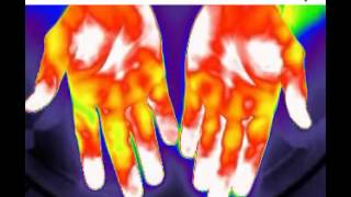 Endothelial Function Test IR Imaging Discovery of VENDYS Neurovascular Reactivity Measurement