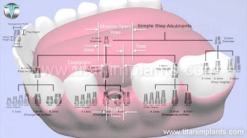Close Tray Impression Technique Using Simple Step Abutments