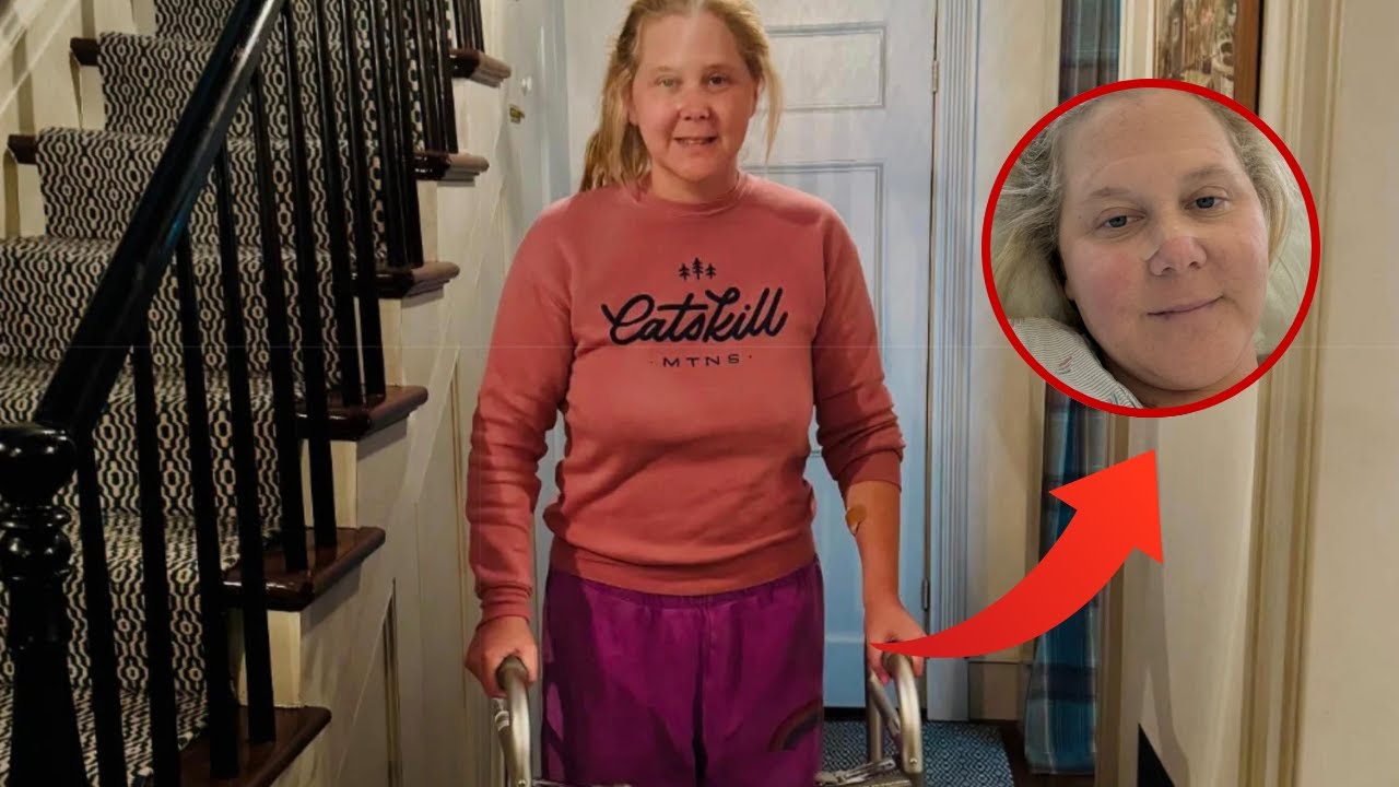 Amy Schumer Opens Up About Chronic Pain & Back Surgery Recovery 2025