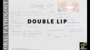Double Lip | Developmental Disturbances Of Lips And Palate Part -2