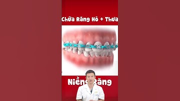 Niềng Răng Hô Móm | Nha Khoa Minh Châu