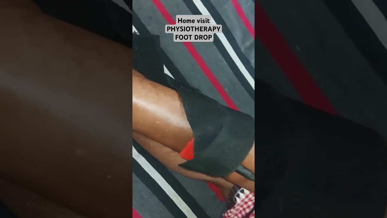 HOME VISIT PHYSIOTHERAPY TREATMENT FOR FOOT DROP