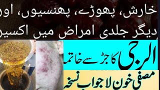 best acne treatment || skin allergy ka ilaj || athra ka ilaj || arq musaffi khoon || hakeem safdar.