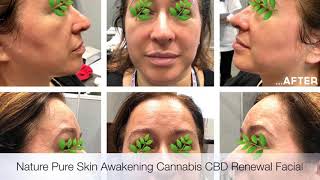 Skin Awakening Cannabis CBD Renewal Facial Protocol Demonstration