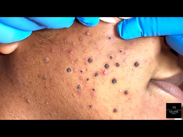 Satisfying extractions