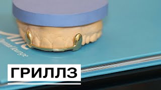 Что такое ГРИЛЗ? Зачем нужны грилзы? Стоматология  | InSmile | Глеб Пекли