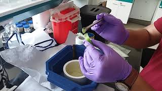 Squashing of leaf sample with liquid nitrogen for DNA isolation