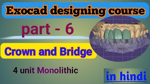 4 unit bridge Design Zirconia in exocad ||exocad crown design Tutorial in hindi/exocad 3.2 elefsina