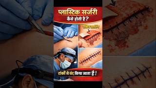 Plastic Surgery Kaise Hoti Hai? 😱 Full Process Explained #shorts