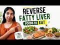 What to Eat for Fatty Liver #reversefattyliver