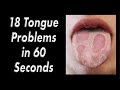 18 tongue problems in 60 seconds