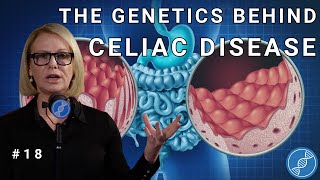 Understanding the Genetics of Celiac Disease