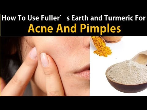 How To Use Fuller’s Earth and Turmeric For Acne And Pimples