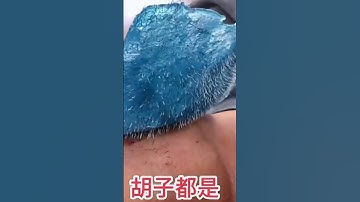 Satisfying Relaxing Large Blackheads Extraction | Removal Pimple Popping |  Pimples Slimes | Acne