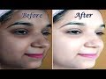 Skin Whitening Miracle Formula in just 10 Minutes (With Live Result)