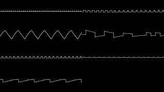 Gangsta's Paradise 8 bit remix (Non vocals) | NES 2A03 + VRC6 (Oscilloscope view)