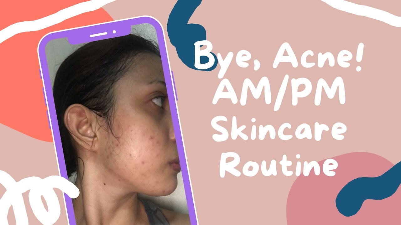 My Acne Fighting Skincare Routine and Newfound Love for K-Beauty