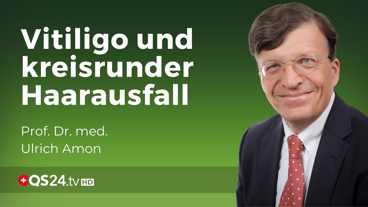 Ursache und Therapie von der Vitiligo-Weissfleckenkrankheit und kreisrundem Haarausfall | QS24