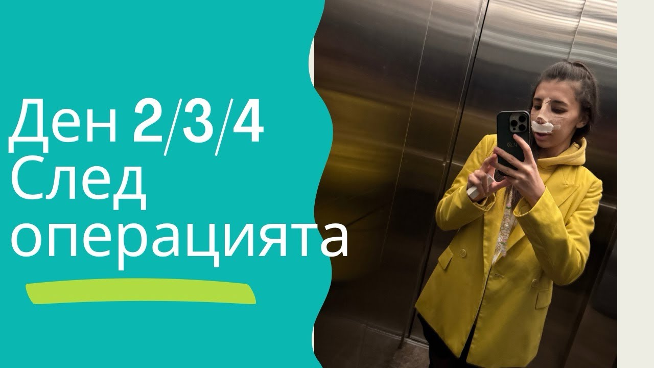 Ден 2/3/4 след операцията ми по ринопластика