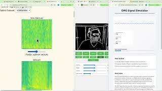 Building Neural Networks for Seizure Detection: From EMG to EEG Signal Processing | 96% Accuracy