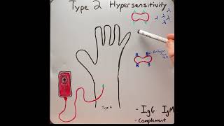 Type 2 hypersensitivity reaction in 2 mins!