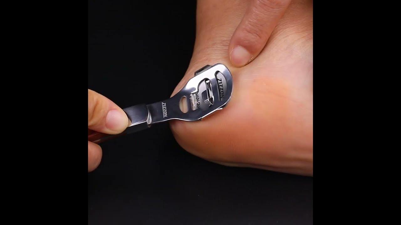 Foot Care Pedicure Callus Shaver Hard Skin Remover Wood Handle 10