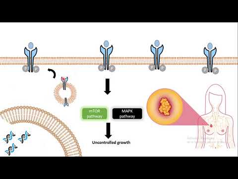 Clinical usage of antibody: Herceptin (Antibody as breast cancer medicine)