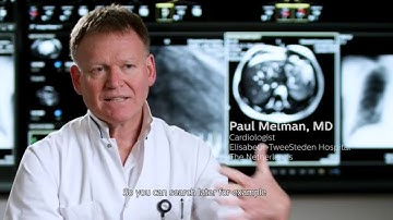 Philips IntelliSpace Cardiovascular at ETZ, Tilburg – Diagnostic guidance