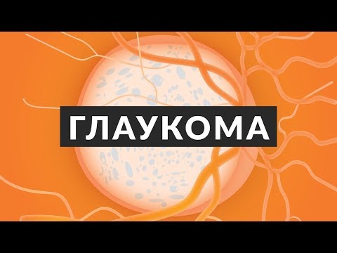 Что такое глаукома? Это причина №1 необратимой слепоты в мире! 7 важных фактов. Доктор Лапочкин