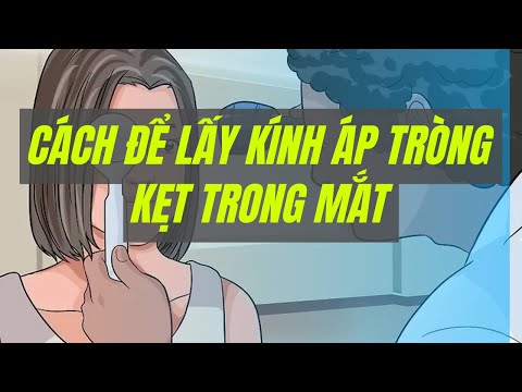 Video: 3 cách để loại bỏ kính áp tròng bị mắc kẹt