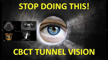 Stop With The Tunnel Vision!   CS 3D Imaging Software
