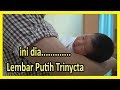 Ini Dia.......... Lembar Putih Trinycta