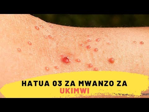 Video: Hatua Za Kuzuia Uchungu Wa Vidole Wakati Unacheza Piano