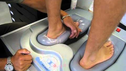 Customized Insoles process