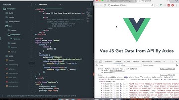 vuejs get data from api by axios
