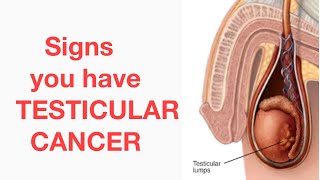 Testicular Cancer: D&N Medical Series