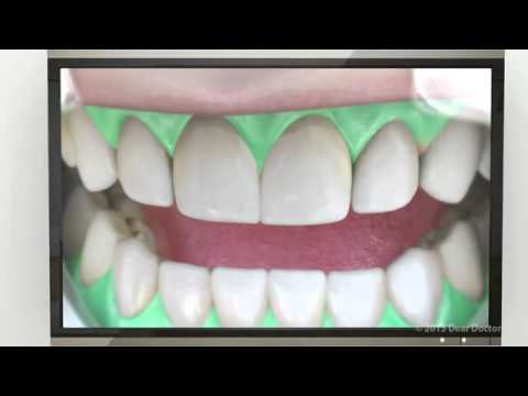 Βίντεο: Η Λίνα στην οδοντιατρική: συνάντηση γιατρών