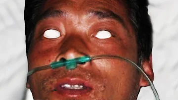 ¿Qué le pasó a Hisashi Ouchi?