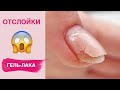 Причины отслойки гель-лака | Секреты носки маникюра