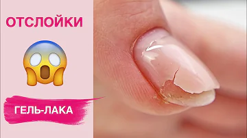 Почему база дает отслойки