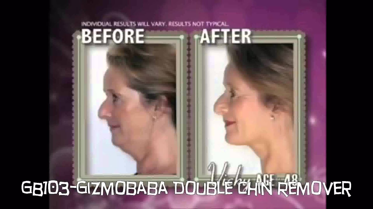 Gb103 Gizmobaba Double Chin Remover