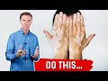 Vitiligo: Do These 3 Things