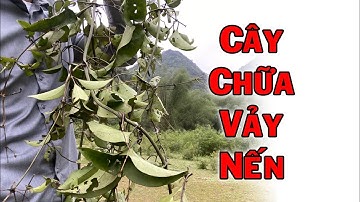 Trời ban cho dân ta cây thuốc chữa Vảy nến 100 người thì 99 người không biết || Thaoduoc net