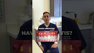 How do you know if you have #gingivitis I’ll tell you… 🪥🦷#dentist #dentalcare
