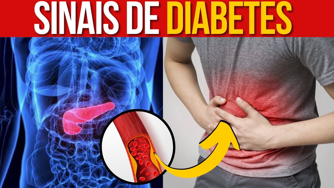 Sinais e Sintomas da Diabetes: Reconhecendo os Alertas Precoces - YouTube