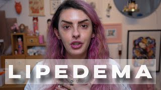 Thumbnail for TUDO SOBRE LIPEDEMA E O MEU DIAGNÓSTICO - Karen Bachini