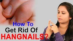 How To Get Rid Of Hangnails सुतला से छुटकारा कैसे पायें? | Nail Care Tips - Lifestyle